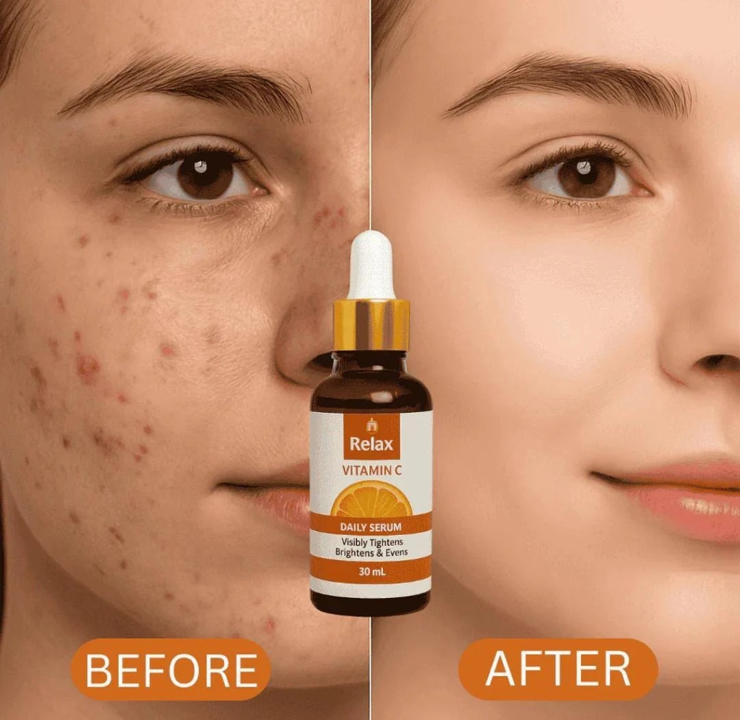 Relax Vitamin C Brightening Serum – 30ml